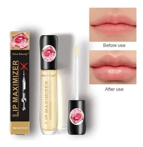 LABIAL DE COLAGENO
